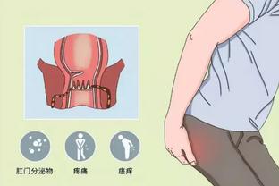 津媒：王秋明膝盖内侧副韧带伤势基本痊愈，体能储备是训练重点
